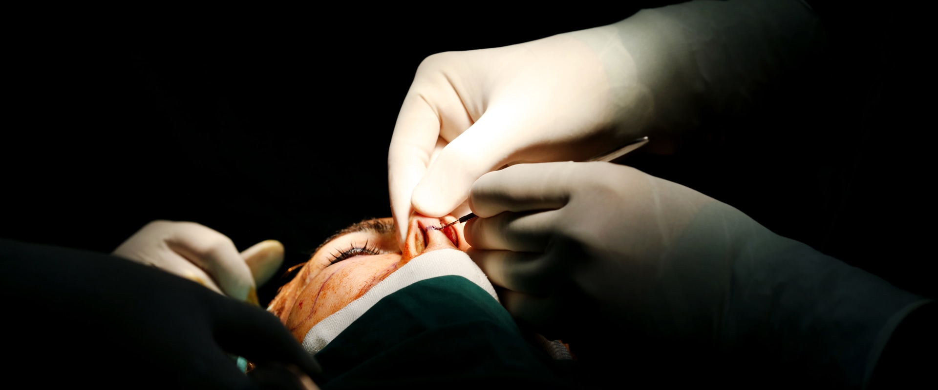 Can Insurance Cover Cosmetic Surgery?