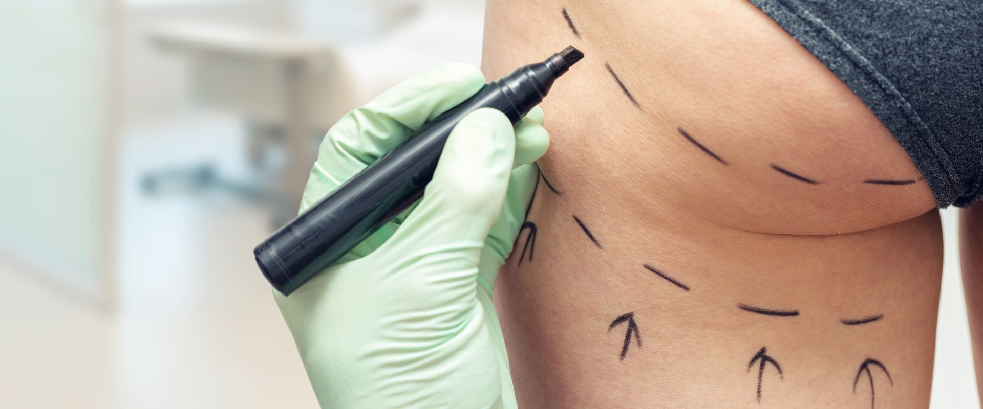 The Most Dangerous Types of Cosmetic Surgery