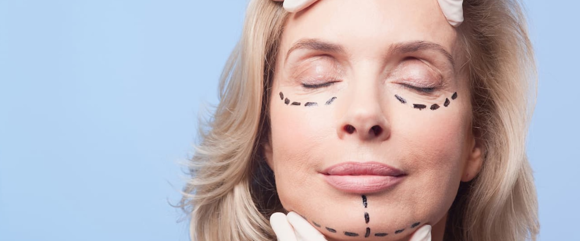 Can You Deduct Cosmetic Surgery on Your Taxes?