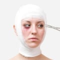 The Psychological Impact of Plastic Surgery