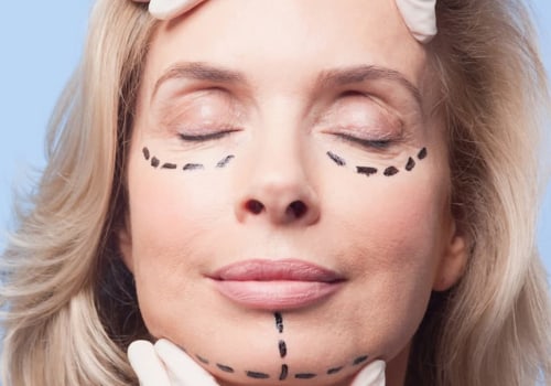 Can Cosmetic Surgery be a Business Expense?