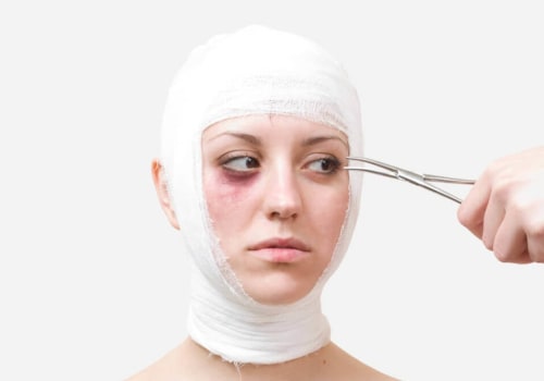 The Pros and Cons of Cosmetic Surgery
