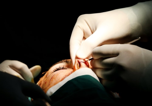 What Cosmetic Surgery Does Insurance Cover?